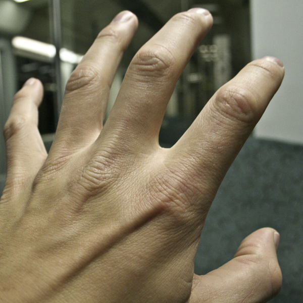 Hand, die